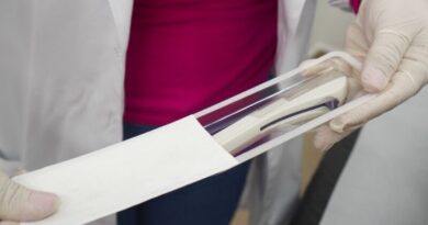Enfermeiros de Ribeirão Pires recebem capacitação para inserção do Implanon